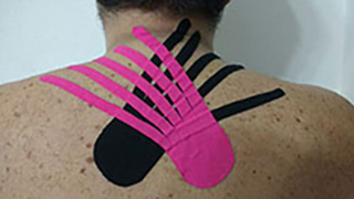 kinesio taping