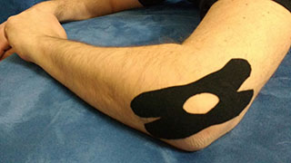 kinesio taping