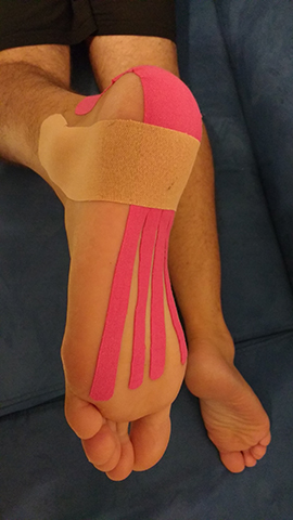 kinesio taping